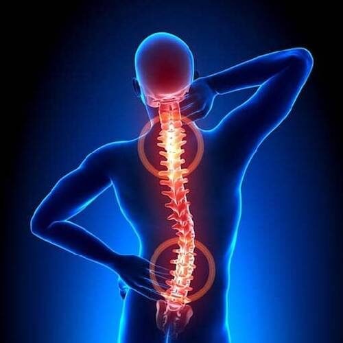 Back Pain_image_krayog